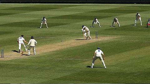 MCG