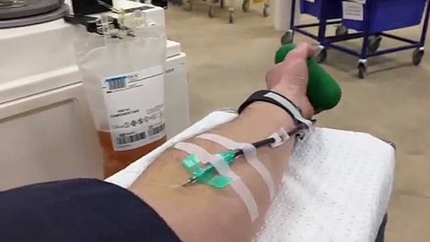 plazma therapy