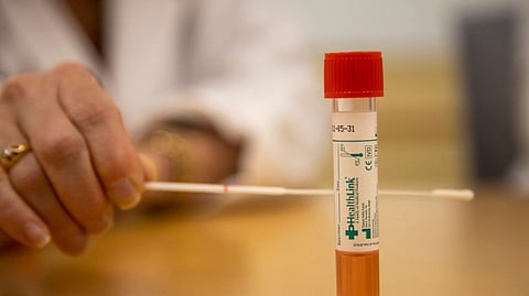 eight swab samples to resned for test
