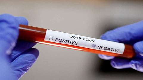 Two different corono reports of the patient from Pune & Dhule Laboratory