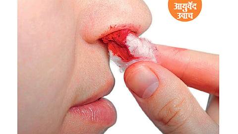 पथ्यापथ्य-रक्‍तपित्त