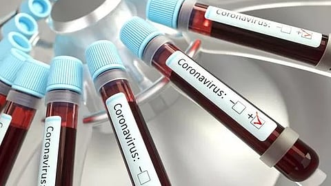 Corona-Blood-Samples
