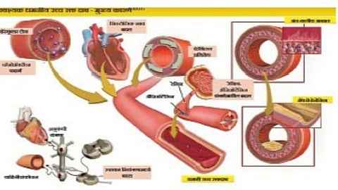 Rising blood pressure can be controlled in time health marathi news
