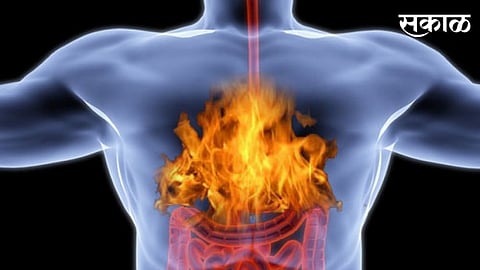 know remedies to control acidity in few minutes Nagpur News  