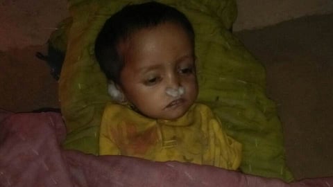 boy dead on malnutrition 
