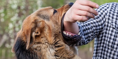 anti-rabies vaccine is not avilable in nagpur corporation hospital
