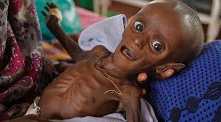 One thousand eight hundred and eighty six malnourished children in the district