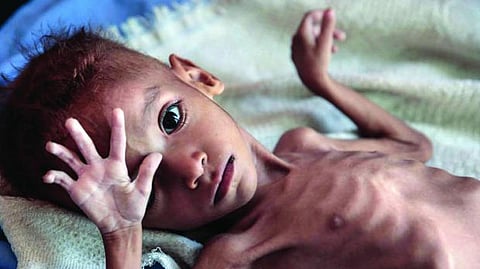 Malnutrition Elimination News
