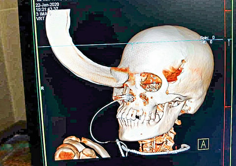 Life-threatening attack on the elderly