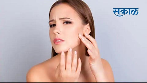 तुमचा चेहरा सकाळी उठल्यावर सूजलेला दिसताे? जाणून घ्या सूज दूर करण्याचे उपाय