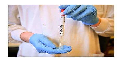 The swab report will be of late