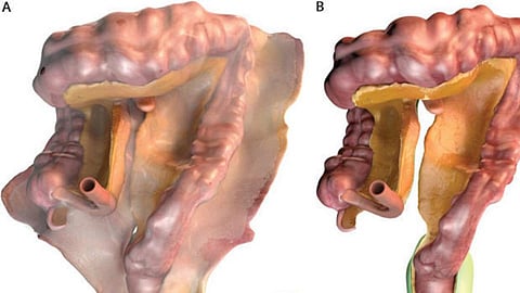 New Body Organ 