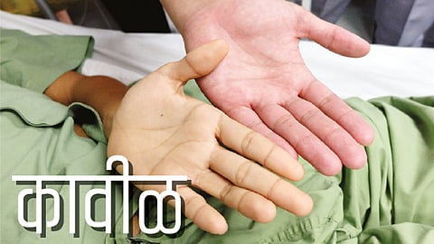 #FamilyDoctor कावीळ