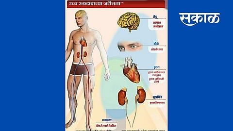 women day special Rising blood pressure in women is a warning sign marathi news