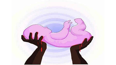 Difficult Surgery By Dr Ram Mestry In Rajapur Rural Hospital 