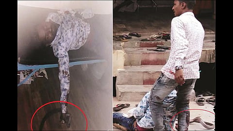 After taking a bitten cobra, he traveled 10 km to the hospital at nanded