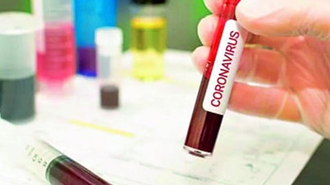 coronavirus