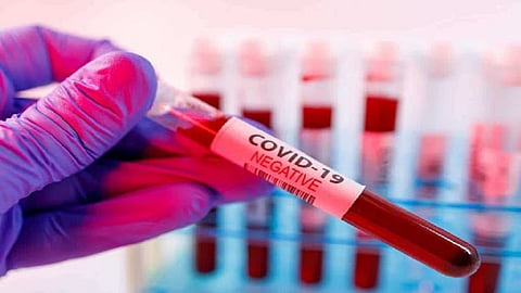 covid negative