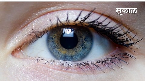 The time of blindness will come upon the poor without treatment medical hospital news