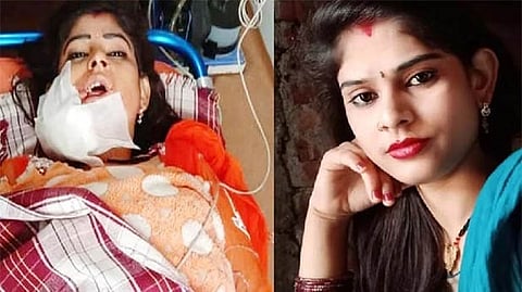 डान्स थांबवला म्हणून झाडली होती गोळी; आता 'ती' लढतीये परिस्थितीशी