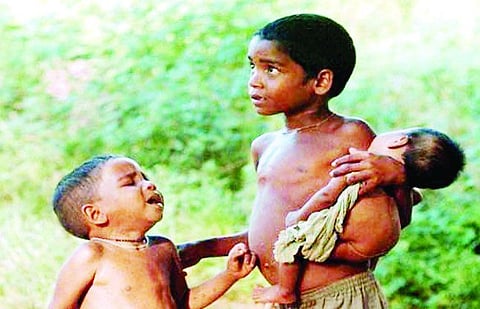 शंभर कोटींचा खर्च होऊनही कुपोषण कायमच! 