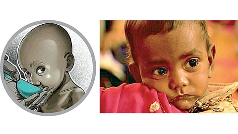 malnutrition
