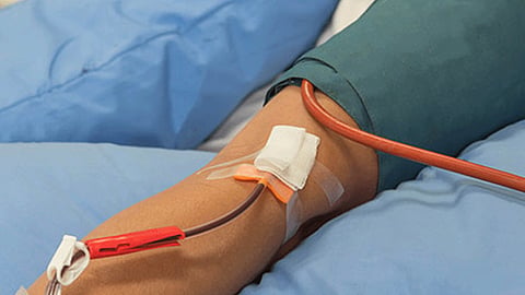 plasma