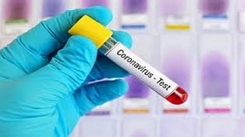 covid test