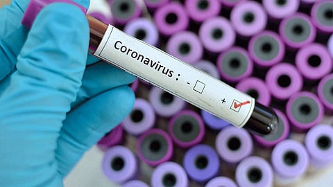 Corona-Virus