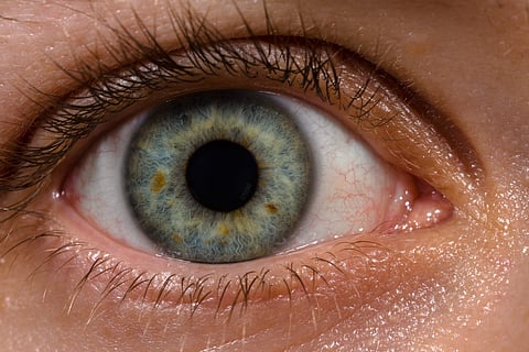 Self-donated eye, Jalna patient treated in Ahmednagar