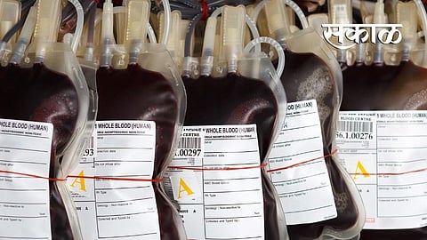 9570 blood bags collected during lockdown period in Yavatmal 
