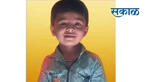 beed child