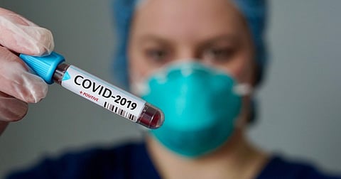 coronavirus 