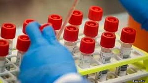 901 Cases Of COVID-19 in Aurangabad