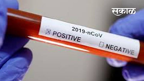 Record of 73000 corona tests in seven days