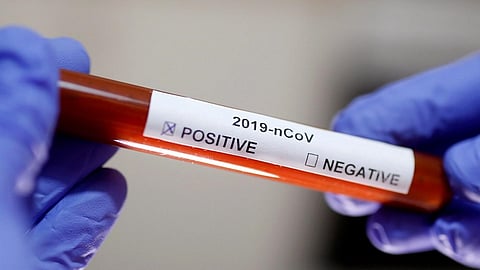 coronavirus test lab pune 