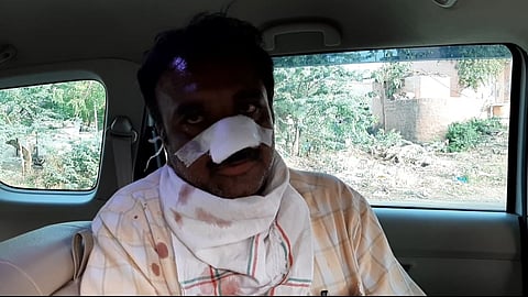 पत्नीच्या धाडस : बिबट्याच्या हल्ल्यातून वाचविले पतीला 