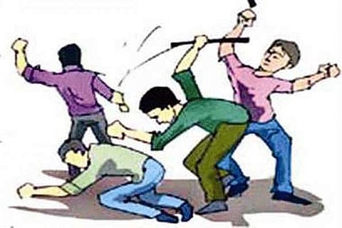 Bone fracture in husband & wife's squabble