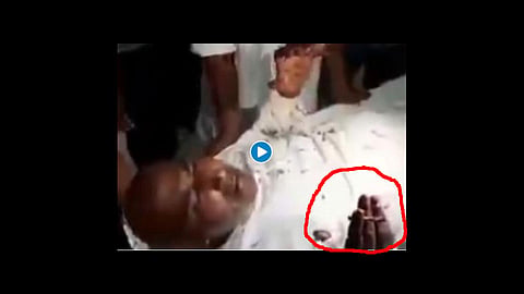 man smoking beedi while lying hospital stretcher video viral