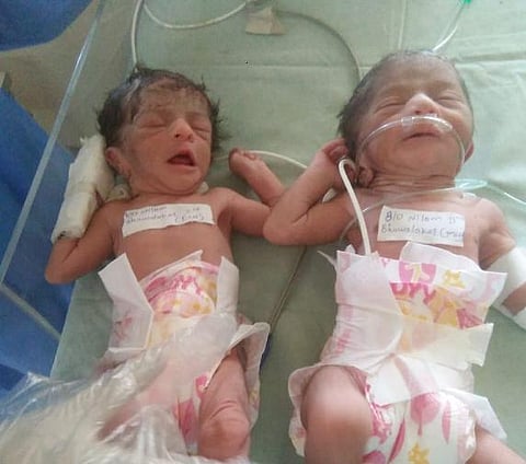 Corona patient dies after giving birth to two children
