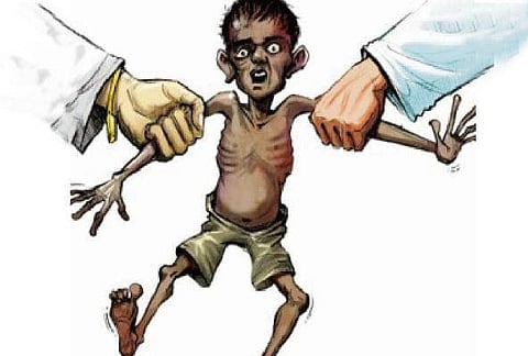 malnutrition
