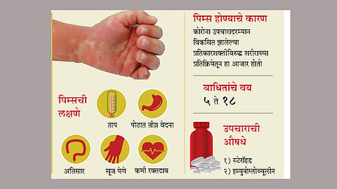 कोरोनानंतर मुलांमधील "पिम्स' आजारासंबंधी डॉक्‍टरांचा सल्ला वाचा सविस्तर