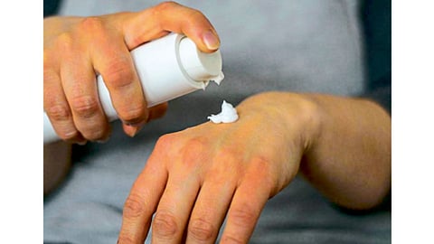 psoriasis
