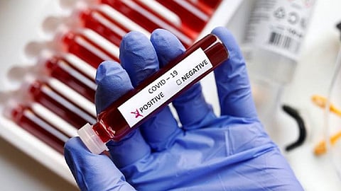 test-kits-2.jpg
