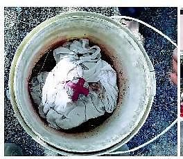 சிதம்பரத்தில் நாட்டுகுண்டு வெடித்து ஒருவர் படுகாயம்﻿