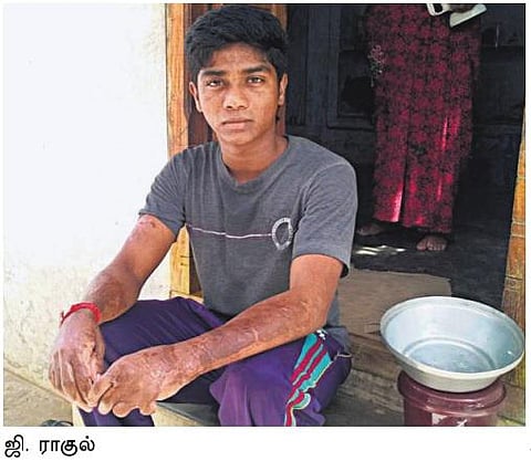 கும்பகோணம் கொடுமை: தீயில் தப்பிய மாணவர்கள் சொல்வதென்ன?﻿
