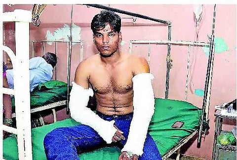 காலில் விழுந்து வணங்கச் சொல்லி பொறியியல் கல்லூரி மாணவரிடம் ராகிங்﻿: உருட்டுக் கட்டையால் தாக்கியதால் கைகளில் எலும்பு முறிவு﻿