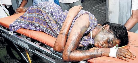 மதுரையில் மாணவிகள் மீது ஆசிட் வீசியது யார்?﻿: போலீஸாரிடம் இன்னமும் சிக்காத குற்றவாளி﻿