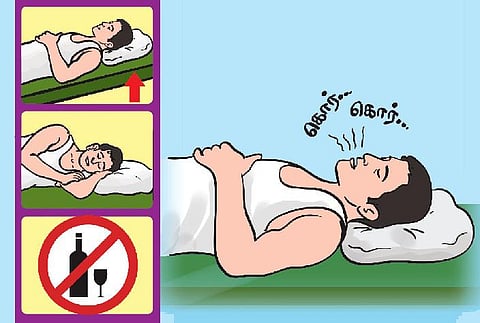 குறட்டை விடுவது ஏன்?﻿