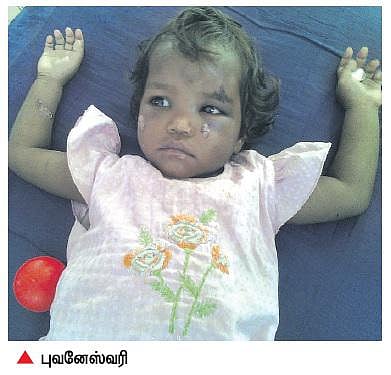 கடன் பாக்கிக்காக குழந்தைக்கு சூடு: திருப்பத்தூர் தம்பதி மீது வழக்கு பதிவு﻿